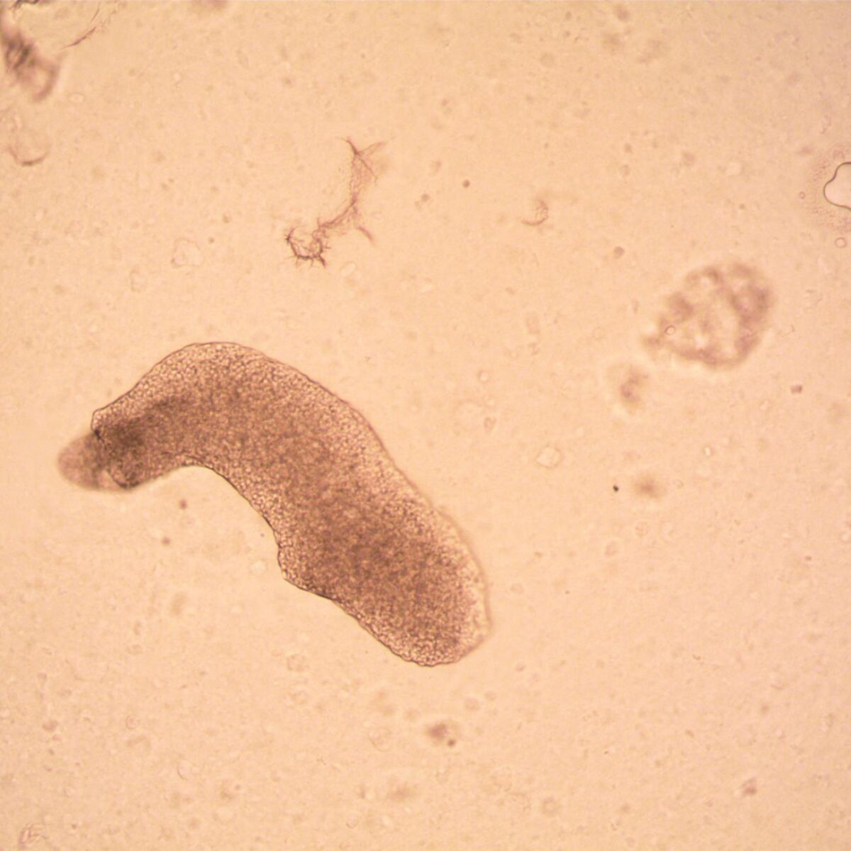 Para entender o animal mais resistente do mundo, o tardígrado, saiba que ele suporta condições extremas. Conhecido como urso