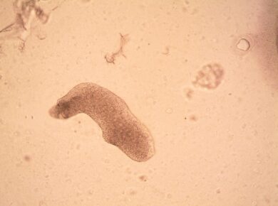 Para entender o animal mais resistente do mundo, o tardígrado, saiba que ele suporta condições extremas. Conhecido como urso