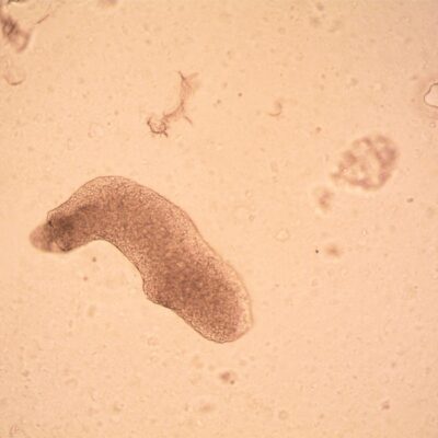 Para entender o animal mais resistente do mundo, o tardígrado, saiba que ele suporta condições extremas. Conhecido como urso