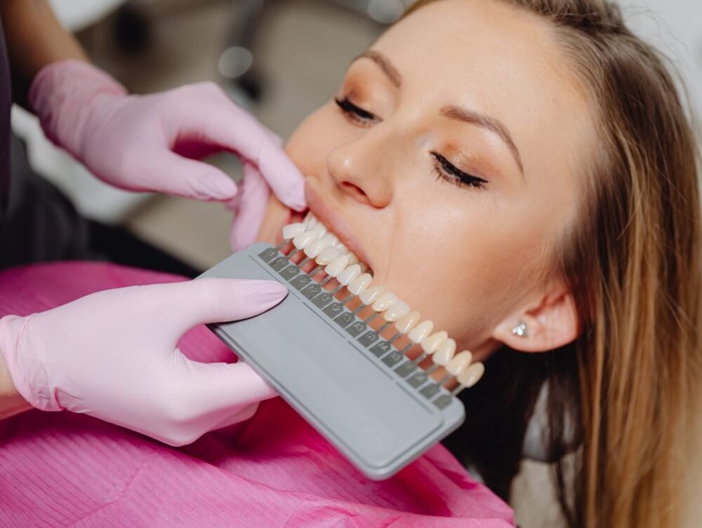 Facetas dentárias