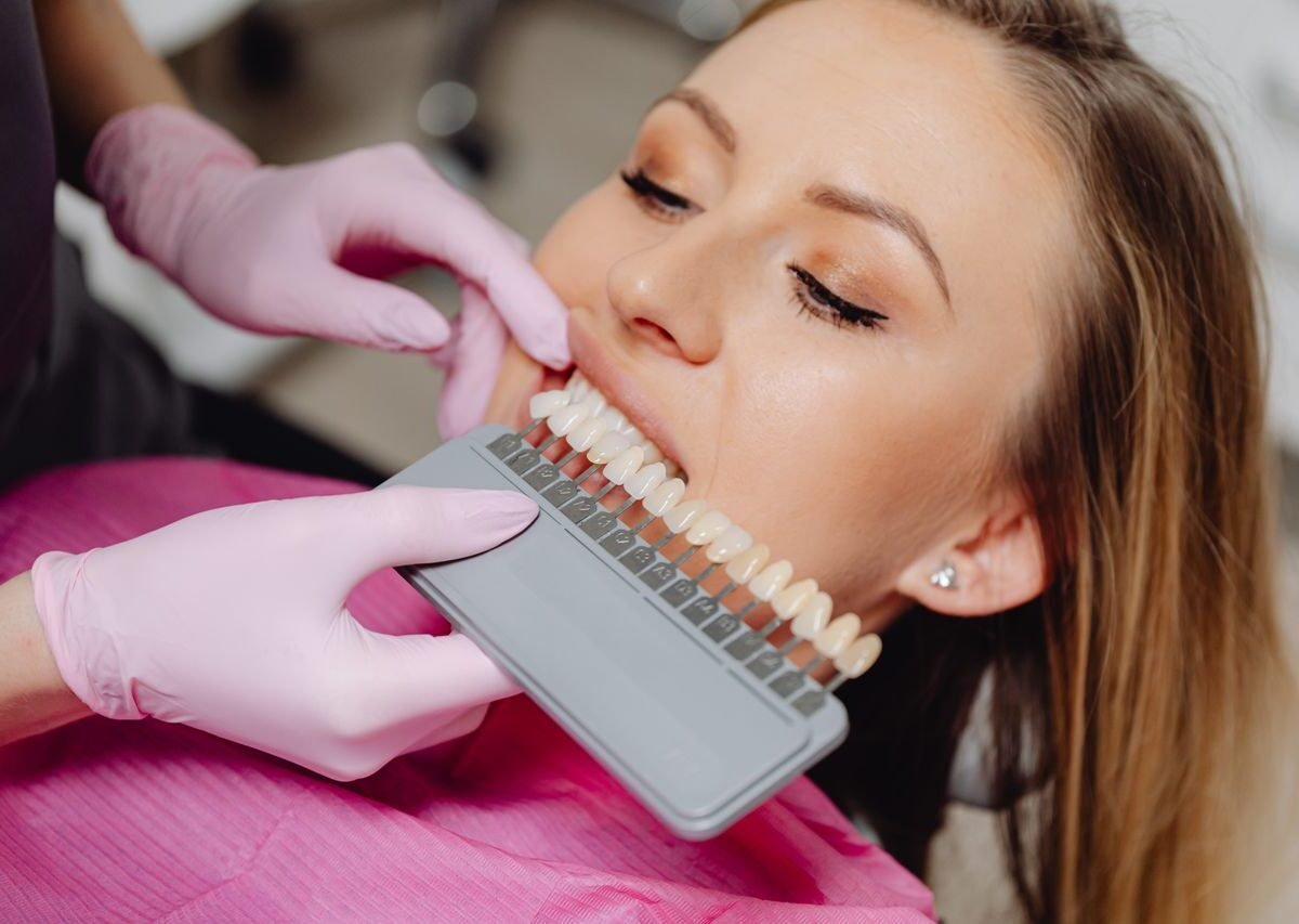 Facetas dentárias