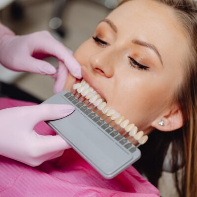 Facetas dentárias
